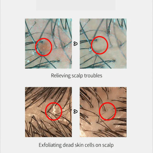 Silicon Hair Scalp Massager Brush - VMX PETS - VMX PETS